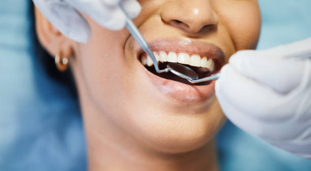 Best Emergency Dental Care for Broken or Chipped Teeth in Reidville, SC